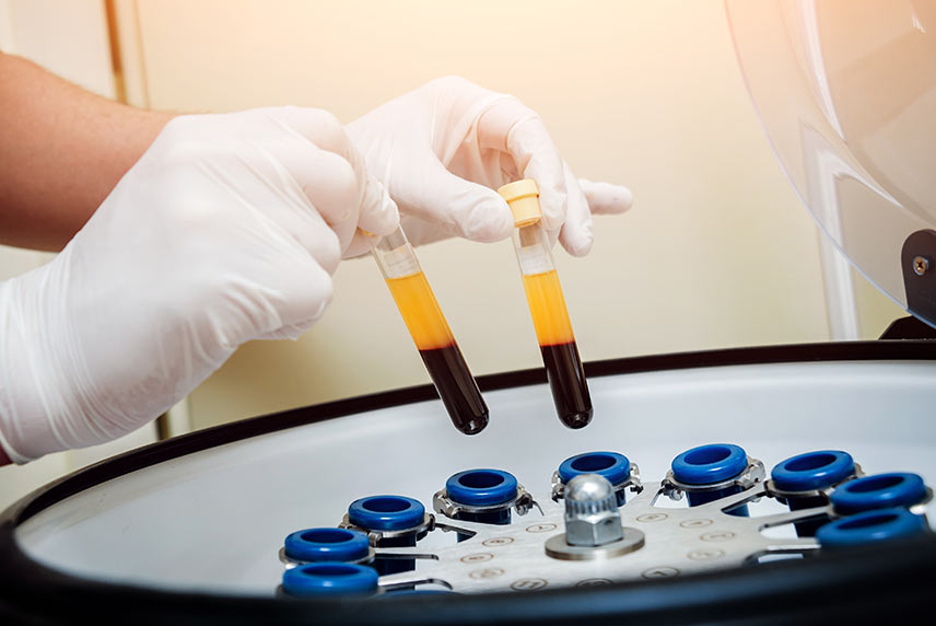 Technician placing blood sample in centrifuge for PRP hair treatment