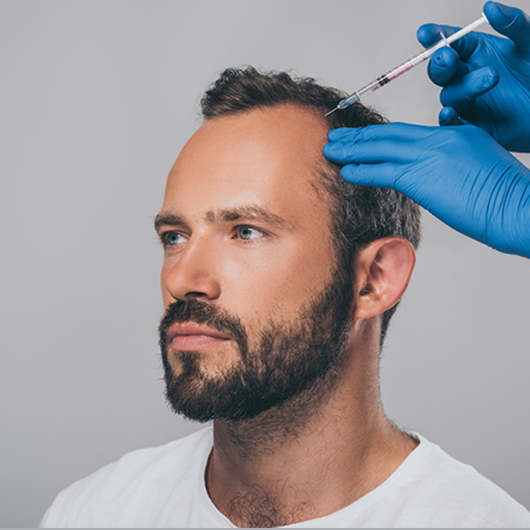 Patient being administered PRP hair treatment