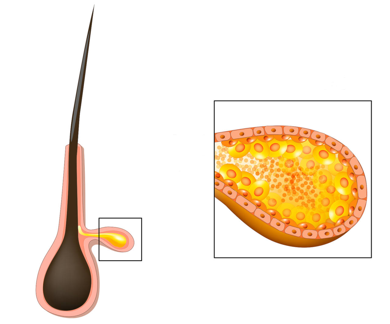 la glande sébacée est responsable de la production de sébum pour vos cheveux